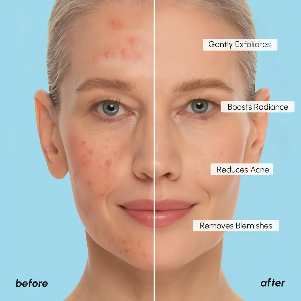 Glycolic Face Pads